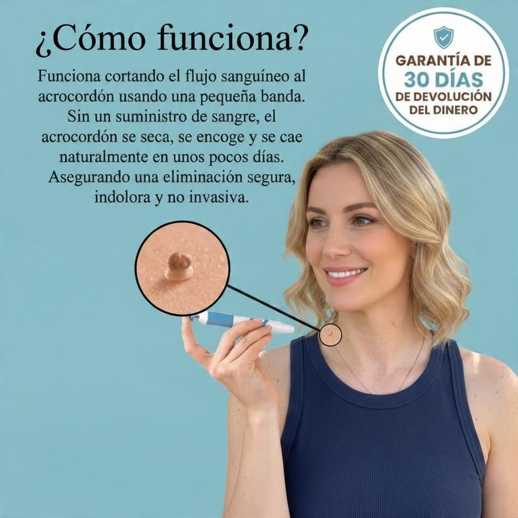 Kit para quitar verrugas sin dolor